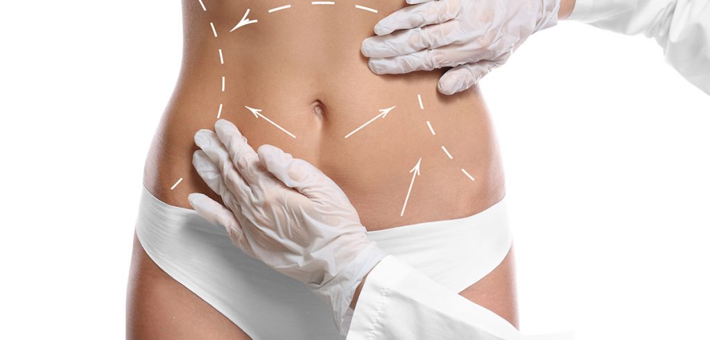 Costs for Tumescent Liposuction