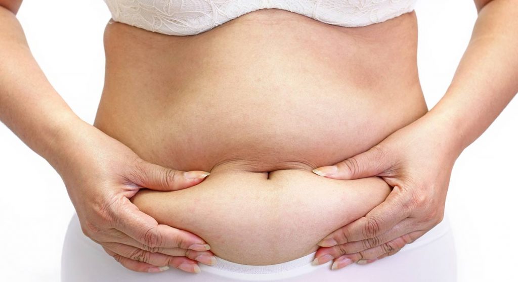 Abdominal Liposuction Belly