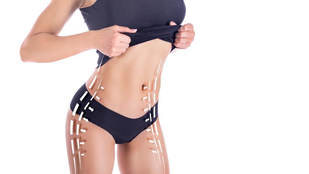 Liposuction and Tummy Tuck